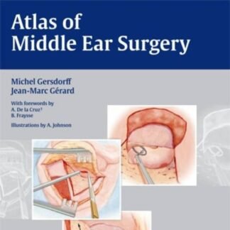 Atlas of Middle Ear Surgery