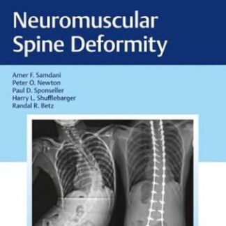 Buku Kedokteran Neuromuscular Spine Deformity