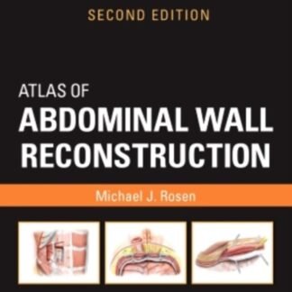 Atlas of Abdominal Wall Reconstruction 2e 2017