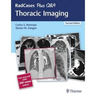 Red Cases Plus Q&A Thoracic Imaging 2nd Edition 2019