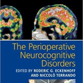 The Perioperative Neurocognitive Disorders 2019