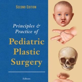 Principles and Practice of Pediatric Plastic Surgery 2e