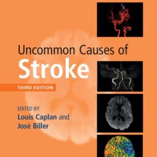 Buku Kedokteran Uncommon Causes of Stroke 3e 2018