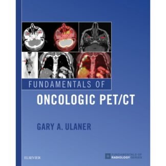Fundamental of Oncologic PET-CT 1e 2019