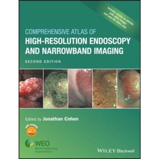 [Full Color /BW] Comprehensive Atlas of High Resolution Endoscopy and Narrowband Imaging 2nd Edition 2017