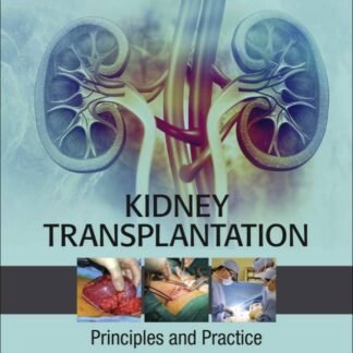 Kidney Transplantation Principles and Practice 8e 2020