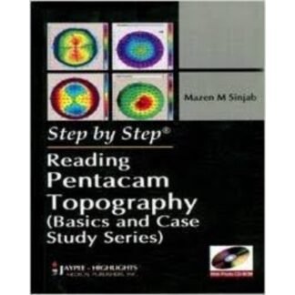 [Full Color /BW] Reading Pentacam Topography 2010