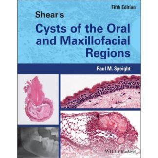 [Full Color /BW] Shear Cysts of the Oral and Maxillofacial Regions