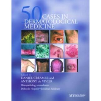 [Full Color /BW] 50 Cases in Dermatology Medicine