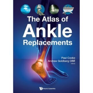 [Full Color /BW] The Atlas of Ankle Replacement 2021