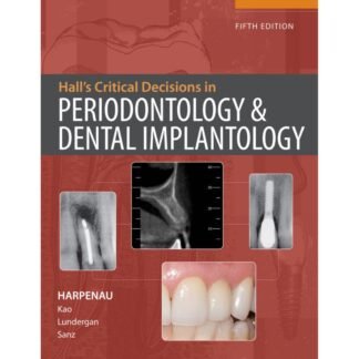 [Full Color /BW] Halls Critical Decisions in Periodontology and Dental Implantology 5th 2013