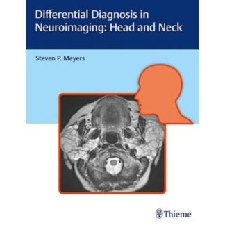 Differential Diagnosis in Neuroimaging 2017