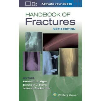 Handbook of Fracture 6th Edition 2020
