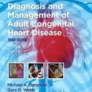 Diagnosis and Management of Adult Congenital Heart Disease 3e