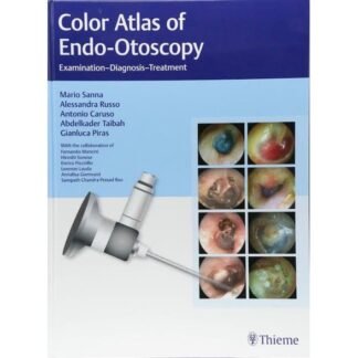 [Full Color] Color Atlas of Endo-Otoscopy