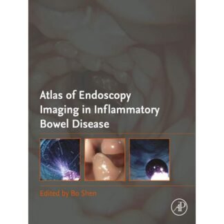 Atlas of Endoscopy Imaging in Inflammatory Bowel Disease 2020