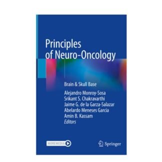[Full Color /BW] Principles of Neuro Oncology 2021