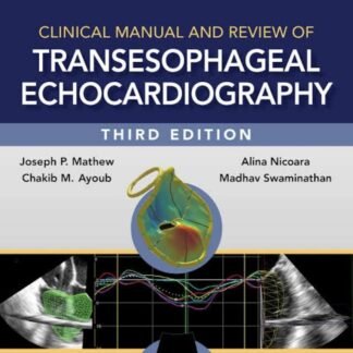 Clinical Manual and Review of Transesophageal Echocardiography 3e 2020