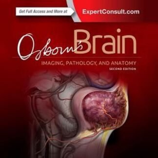 Buku Kedokteran Osborn Brain 2e