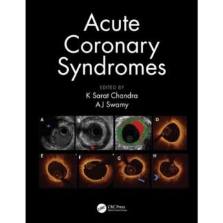 [Full Color /BW] Acute Coronary Syndrome 2021