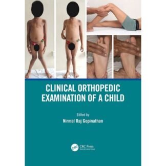 [Full Color /BW] Clinical Orthopaedic Examination of a Child 2021