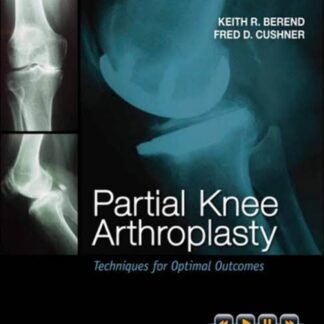 Buku Kedokteran Partial Knee Arthroplasty