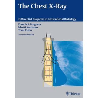 The Chest X-Ray Differential Diagnosis