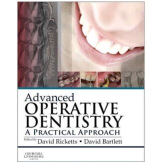[Full Color] Advanced Operative Dentistry