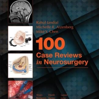 100 Case Review of Neurosurgery 2017