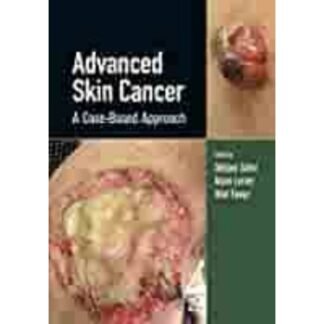 [Full Color] Advanced Skin Cancer 2022