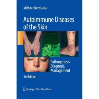 [Full Color /BW] Autoimmune Diseases of the Skin 3rd Edition 2011