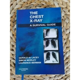 The Chest X-Ray A Survival Guide