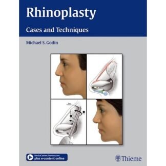 [Full Color /BW] Rhinoplasty Cases and Techniques 2012
