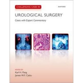 [Full Color /BW] Challenging Cases in Urological Surgery 2023