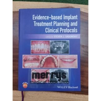 [Full Color /BW] Evidence Based Implant Treatment Planning and Clinical Procedures