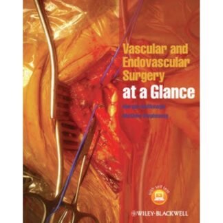 [Full Color /BW] Vascular and Endovascular Surgery at a Glance 2014