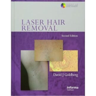 [Full Color] Laser Hair Removal 2nd Edition 2008