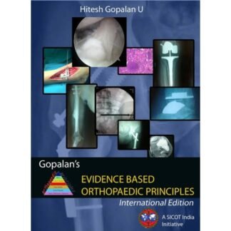 [Full Color /BW] Gopalan Evidence Based Orthopaedics Principles