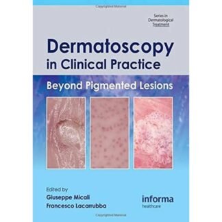 [Full Color] Dernatoscopy in Clinical Practice 2010