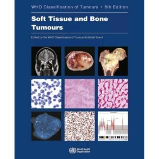 [Full Color /BW] WHO Classification of Tumours of Soft Tissue and Bone 5th Edition 2020