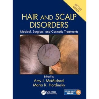 [Full Color/BW] Hair and Scalp Disorders Medical, Surgical, and Cosmetic Treatments 2018