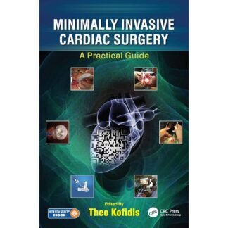 [Full Color/BW] Minimally Invasive Cardiac Surgery A Practical Guide 2021