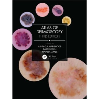 [Full Color/BW] Atlas of Dermoscopy 3e 2023
