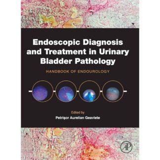 [Full Color/BW] Endoscopic diagnosis and treatment in urinary bladder pathology 2016