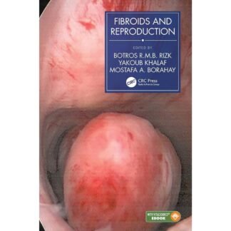 [Full Color/BW] Fibroids and Reproduction 2021