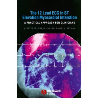 The 12 Lead ECG in ST Elevation Myocardial Infarction 2007