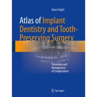 [Full Color/BW] Atlas of Implant Dentistry and Tooth-Preserving Surgery Prevention and Management of Complication 2017