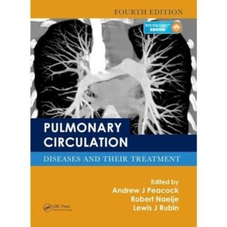 [Full Color/BW] Pulmonary Circulation-Diseases and Their Treatment, 4e 2016