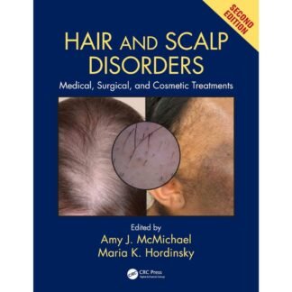 [Full Color/BW] Hair and Scalp Disorders Medical, Surgical, and Cosmetic Treatments 2018