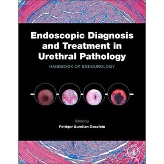 [Full Color/BW] Endoscopic diagnosis and treatment in urethral pathology 2016